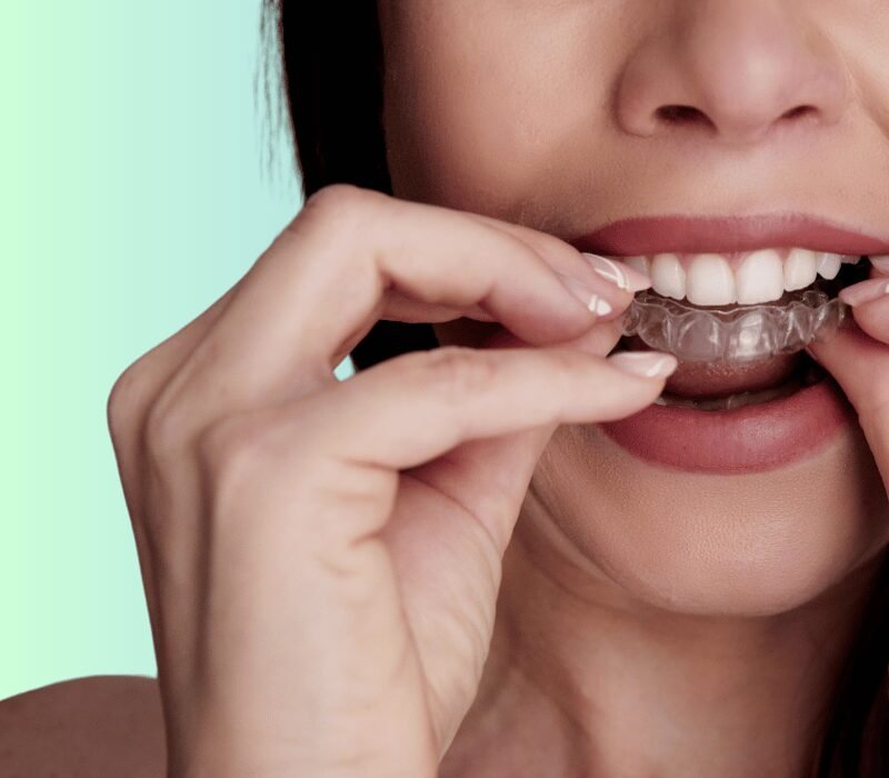 Asian Woman Wearing Angel Aligners - Angel Aligner Singapore